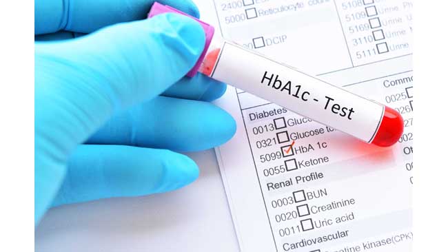 high-hba1c-level-in-jaipur-raises-concerns-amidst-covid-19-pandemic-india-diabetes-care-index