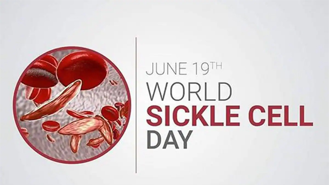 On World Sickle Cell Day, Experts Highlight the Need for Better Management of Sickle Cell Disease as a Public Health Priority